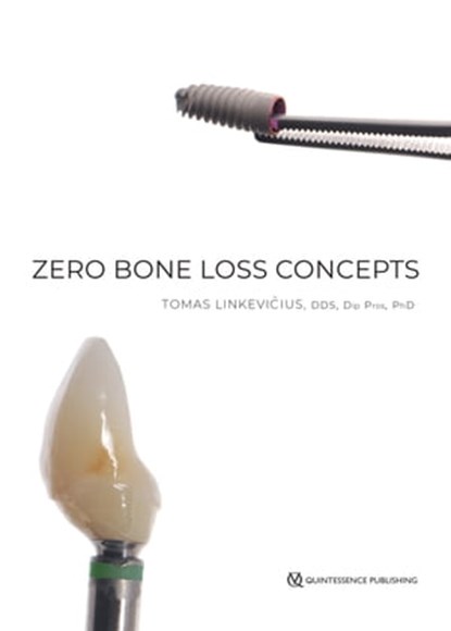Zero Bone Loss Concepts, Tomas Linkevičius - Ebook - 9780867158342