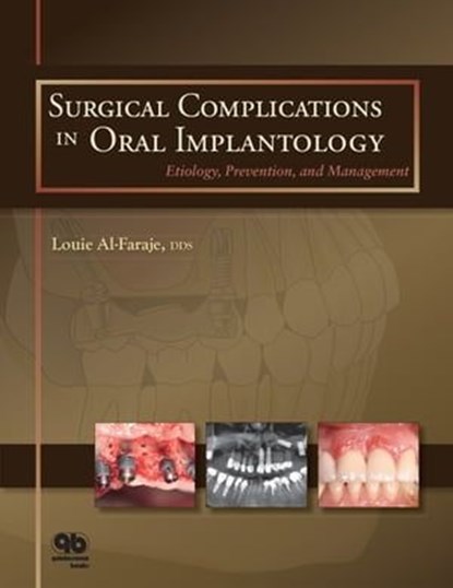 Surgical Complications in Oral Implantology, Louie Al-Faraje - Ebook - 9780867158823