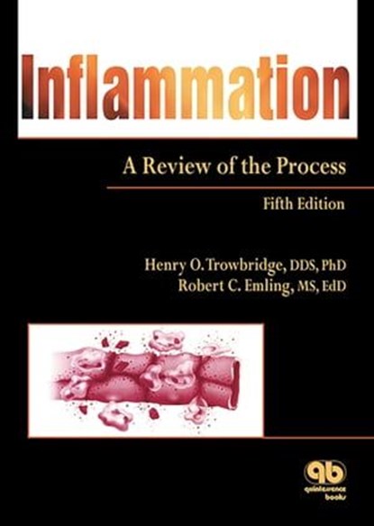 Inflammation, Henry O. Trowbridge ; Robert C. Emling - Ebook - 9780867158953