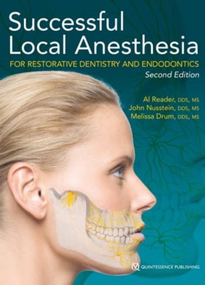 Successful Local Anesthesia for Restorative Dentistry and Endodontics, Al Reader ; John Nusstein ; Melissa Drum - Ebook - 9780867158977