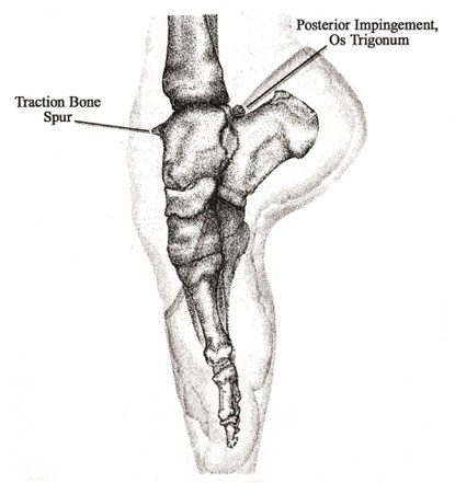 Dance Medicine: Head to Toe, PETERSON,  Judith R. - Gebonden - 9780871273529