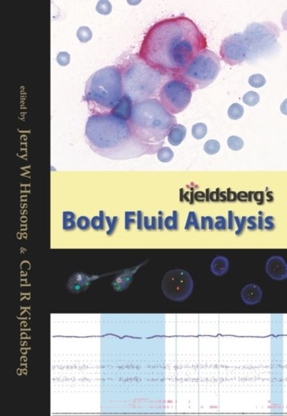 Kjeldsberg's Body Fluid Analysis, Jerry W. Hussong ; Carl R. Kjeldsberg - Gebonden - 9780891895824