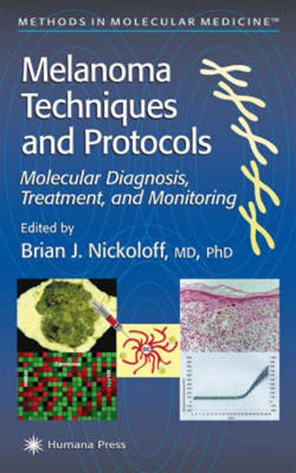 Melanoma Techniques and Protocols, Brian J. Nickoloff - Gebonden - 9780896036840