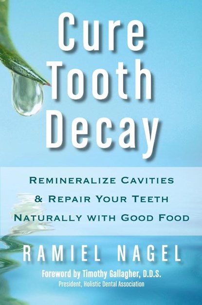 Cure Tooth Decay, Ramiel Nagel ; D D S Timothy Gallagher - Paperback - 9780982021323