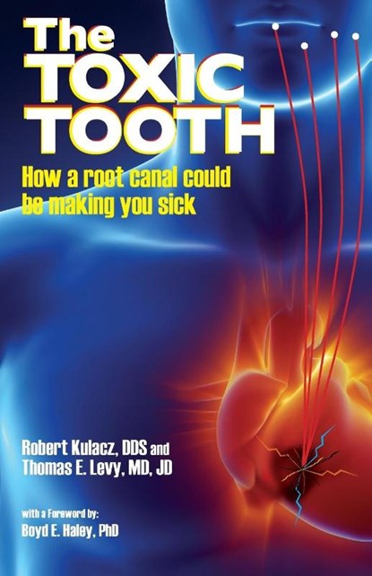 The Toxic Tooth, Dds Robert Kulacz ; Md Jd Levy - Paperback - 9780983772828