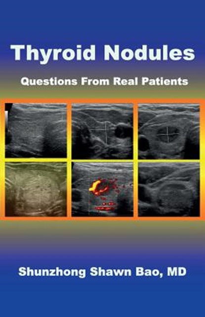 Thyroid Nodules: Questions From Real Patients, Barbara Winter - Paperback - 9780999732205