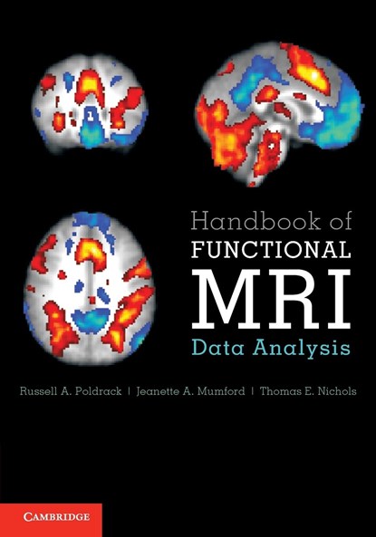Handbook of Functional MRI Data Analysis, RUSSELL A. (STANFORD UNIVERSITY,  California) Poldrack ; Jeanette A. (Stanford University, California) Mumford ; Thomas E. (University of Oxford) Nichols - Paperback - 9781009481168