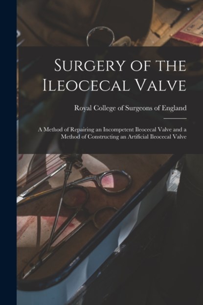 Surgery of the Ileocecal Valve, Royal College of Surgeons of England - Paperback - 9781014418494