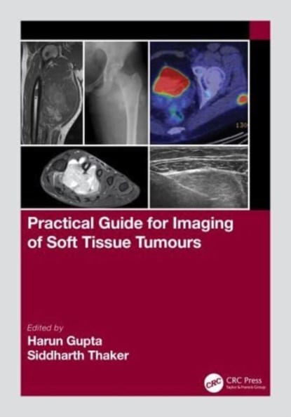 Practical Guide for Imaging of Soft Tissue Tumours, Harun (Leeds Teaching Hospitals Gupta ; Siddharth (Manchester University Hospitals Thaker - Paperback - 9781032111759