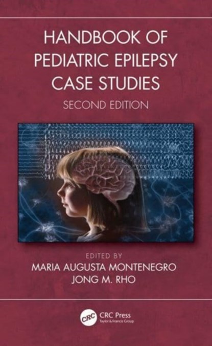 Handbook of Pediatric Epilepsy Case Studies, Second Edition, Maria Augusta Montenegro ; Jong M. (Departments of Neurosciences Rho - Gebonden - 9781032283548
