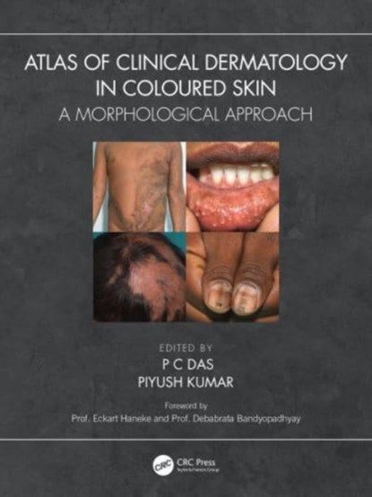 Atlas of Clinical Dermatology in Coloured Skin, P C Das ; Piyush Kumar - Paperback - 9781032399669