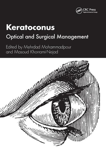Keratoconus, Mehrdad Mohammadpour ; Masoud Khorrami- Nejad - Paperback - 9781032443232