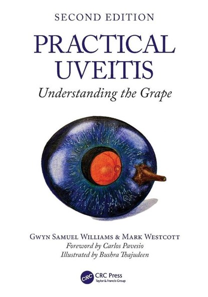 Practical Uveitis, Gwyn Samuel Williams ; Mark (Moorfields Eye Hopsital Westcott - Paperback - 9781032757230