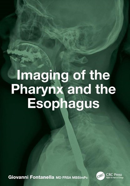 Imaging of the Pharynx and the Esophagus, Giovanni Fontanella - Paperback - 9781032791784