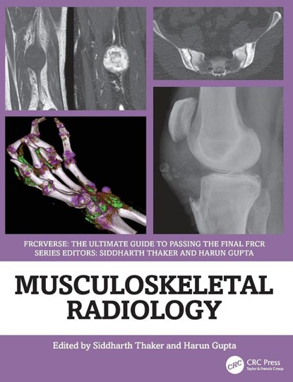 Musculoskeletal Radiology, Siddharth (Manchester University Hospitals Thaker ; Harun (Leeds Teaching Hospitals Gupta - Paperback - 9781032815152