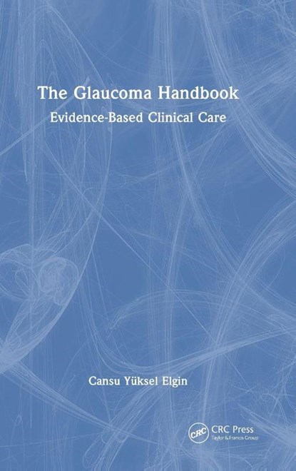 The Glaucoma Handbook, Cansu Yuksel Elgin - Gebonden - 9781041087199