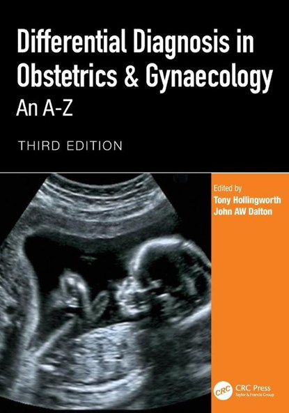 Differential Diagnosis in Obstetrics & Gynaecology, Tony (Consultant in Obstetrics and Gynaecology Hollingworth ; John AW Dalton - Paperback - 9781041239772