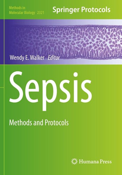 Sepsis, Wendy E. Walker - Paperback - 9781071614907