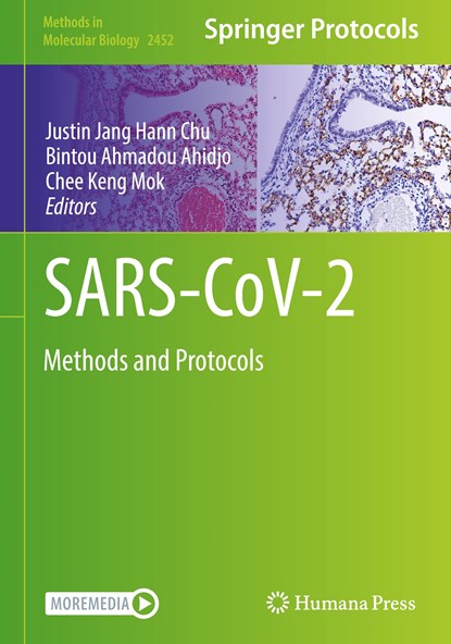 SARS-CoV-2, Justin Jang Hann Chu ; Bintou Ahmadou Ahidjo ; Chee Keng Mok - Gebonden - 9781071621103