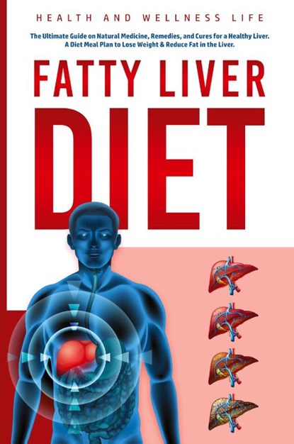 Fatty Liver Diet, Health And Wellness Life - Paperback - 9781087969176