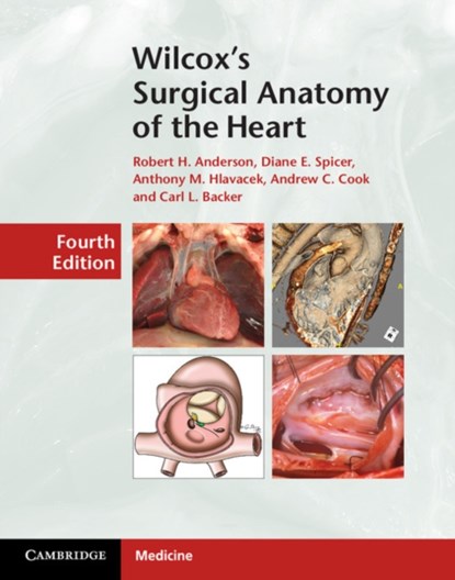 Wilcox's Surgical Anatomy of the Heart, Robert H. (University of Newcastle upon Tyne) Anderson ; Diane E. (University of Florida) Spicer ; Anthony M. (Medical University of South Carolina) Hlavacek ; Andrew C. Cook ; Carl L. Backer - Gebonden - 9781107014480