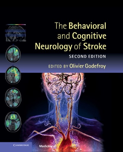 The Behavioral and Cognitive Neurology of Stroke, Olivier Godefroy - Gebonden - 9781107015579