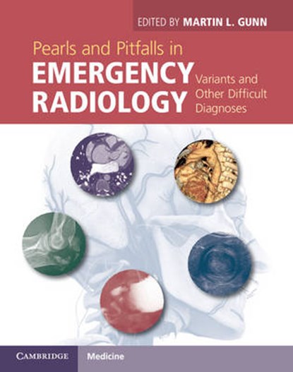 Pearls and Pitfalls in Emergency Radiology, niet bekend - Gebonden - 9781107021914