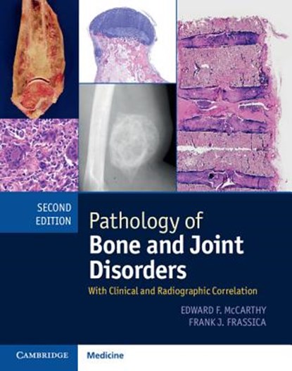 PATHOLOGY OF BONE & JOINT DISO, MCCARTHY,  Edward F. - Gebonden - 9781107041233