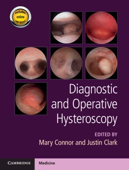 Diagnostic and Operative Hysteroscopy, Mary E. Connor ; T. Justin Clark - Gebonden - 9781107111608