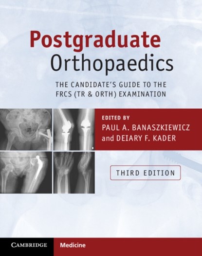 Postgraduate Orthopaedics, Paul A. Banaszkiewicz ; Deiary F. Kader - Paperback - 9781107451643