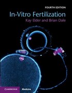 In-Vitro Fertilization | Cambridge) Elder ; Brian Dale Kay (bourn Hall Clinic | 