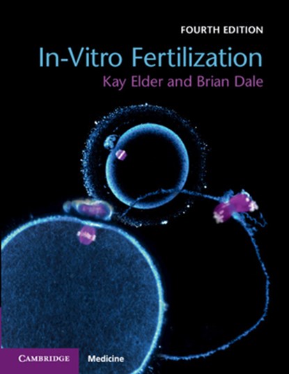 In-Vitro Fertilization, Kay (Bourn Hall Clinic Elder ; Brian Dale - Paperback - 9781108441810