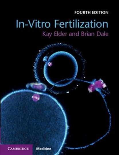 In-Vitro Fertilization, KAY (BOURN HALL CLINIC,  Cambridge) Elder ; Brian Dale - Paperback - 9781108441810