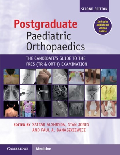 Postgraduate Paediatric Orthopaedics, Sattar (Al Jalila Children’s Specialty Hospital Alshryda ; Stan (Al Ahli Hospital Jones ; Paul A. (Queen Elizabeth Hospital Banaszkiewicz - Paperback - 9781108970617