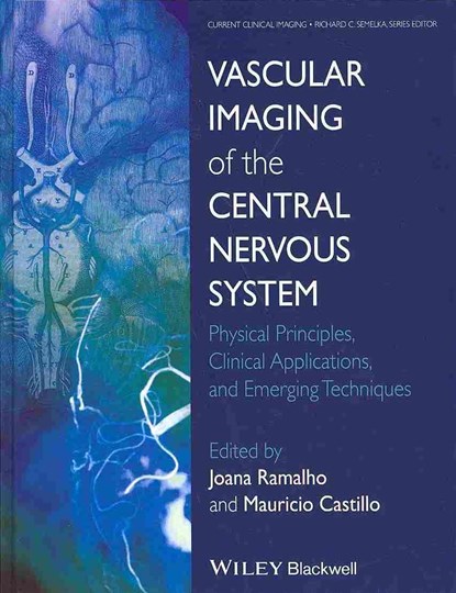 Vascular Imaging of the Central Nervous System, Joana Ramalho ; Mauricio Castillo - Gebonden - 9781118188750