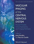 Vascular Imaging of the Central Nervous System | Ramalho, Joana ; Castillo, Mauricio | 