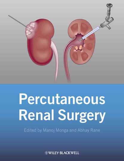Percutaneous Renal Surgery, Manoj Monga ; Abhay Rane - Gebonden - 9781118278734