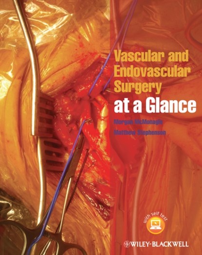 Vascular and Endovascular Surgery at a Glance, MORGAN (HSE SOUTH HOSPITAL GROUP AND THE ROYAL COLLEGE OF SURGEONS IN IRELAND) MCMONAGLE ; MATTHEW (CONSULTANT GENERAL SURGEON,  Jersey General Hospital, Jersey) Stephenson - Paperback - 9781118496039
