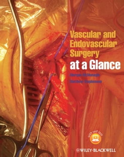 Vascular and Endovascular Surgery at a Glance, Morgan McMonagle ; Matthew Stephenson - Ebook - 9781118496060