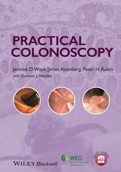 Practical Colonoscopy, Jerome D. Waye ; James Aisenberg ; Peter H. Rubin - Ebook - 9781118553459