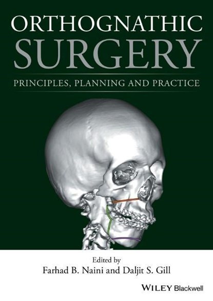 Orthognathic Surgery, Farhad B. (Kingston Hospital; St George's Hospital and Medical School Naini ; Daljit S. (Great Ormond Street Hospital NHS Foundation Trust; UCLH Eastman Dental Hospital Gill - Gebonden - 9781118649978