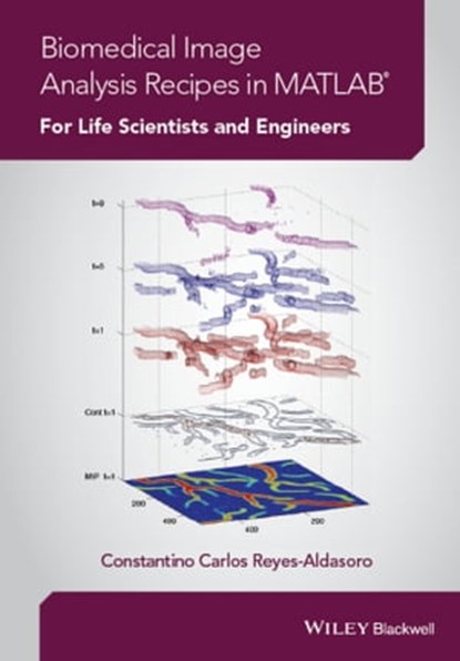 Biomedical Image Analysis Recipes in MATLAB, Constantino Carlos Reyes-Aldasoro - Ebook - 9781118657447