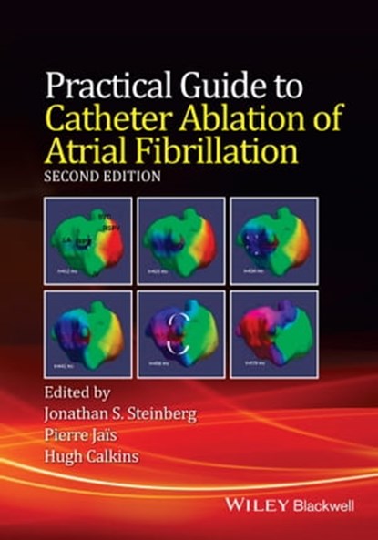 Practical Guide to Catheter Ablation of Atrial Fibrillation, Jonathan S. Steinberg ; Pierre Jais ; Hugh Calkins - Ebook - 9781118658598
