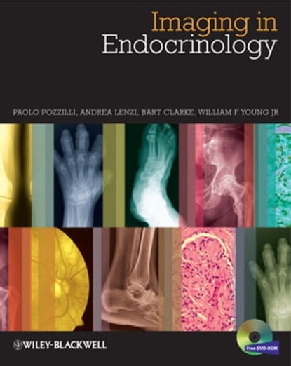 Imaging in Endocrinology, Paolo Pozzilli ; Andrea Lenzi ; Bart L. Clarke ; William F. Young Jr. - Ebook - 9781118749074