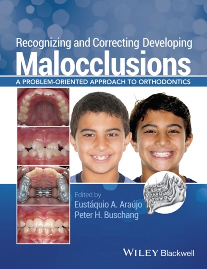 Recognizing and Correcting Developing Malocclusions, EUSTAQUIO A. (SAINT LOUIS UNIVERSITY,  Saint Louis, Missouri, USA) Araujo ; Peter H. (Texas A & M University, Baylor College of Dentistry, Dallas, Texas, USA) Buschang - Paperback - 9781118886120