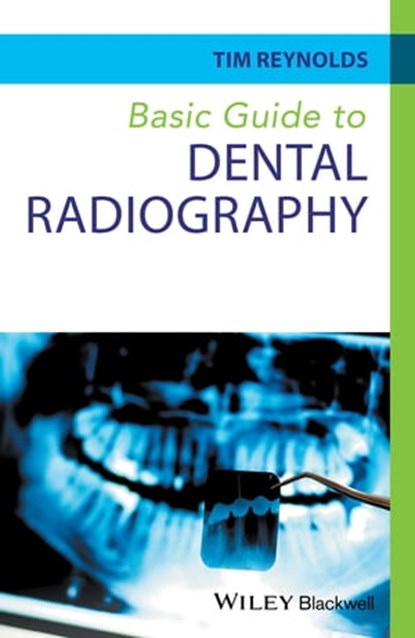 Basic Guide to Dental Radiography, Tim Reynolds - Ebook - 9781118916278