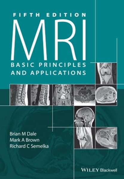 MRI, Brian M. Dale ; Mark A. Brown ; Richard C. Semelka - Ebook - 9781119013037