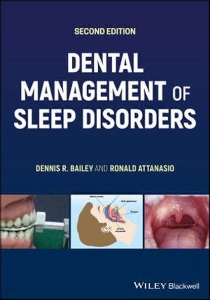 Dental Management of Sleep Disorders, Dennis R. Bailey ; Ronald Attanasio - Ebook - 9781119014621