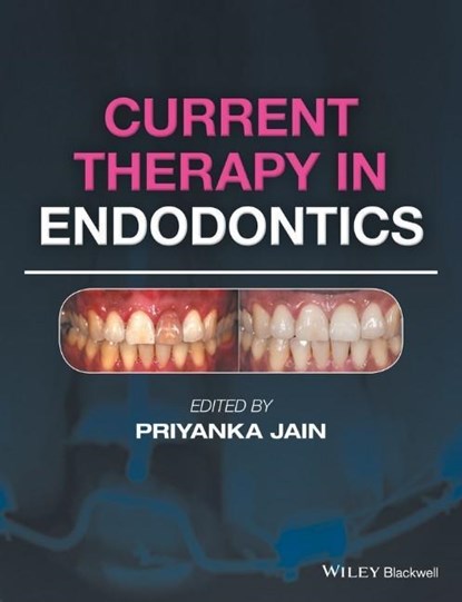 Current Therapy in Endodontics, PRIYANKA (DUBAI,  UAE) Jain - Gebonden - 9781119067559