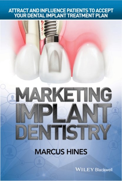 Marketing Implant Dentistry, MARCUS (BIOHORIZONS IMPLANT SYSTEM,  MD, USA) Hines - Gebonden - 9781119114512